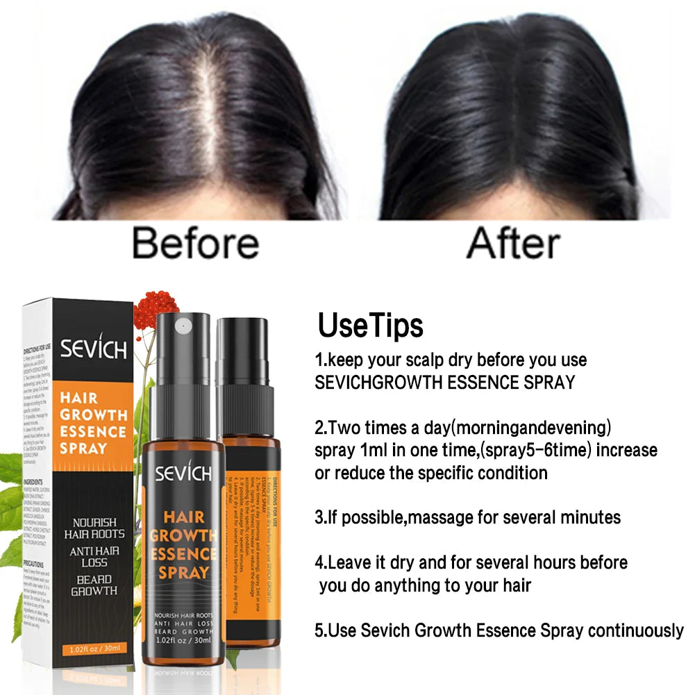 Natural Ginger Hair Growth Essence Oil 30ml Anti Alopecia Dense Regrowth Sprayer Powerful Hair Growth Serums Hair Loss Products
