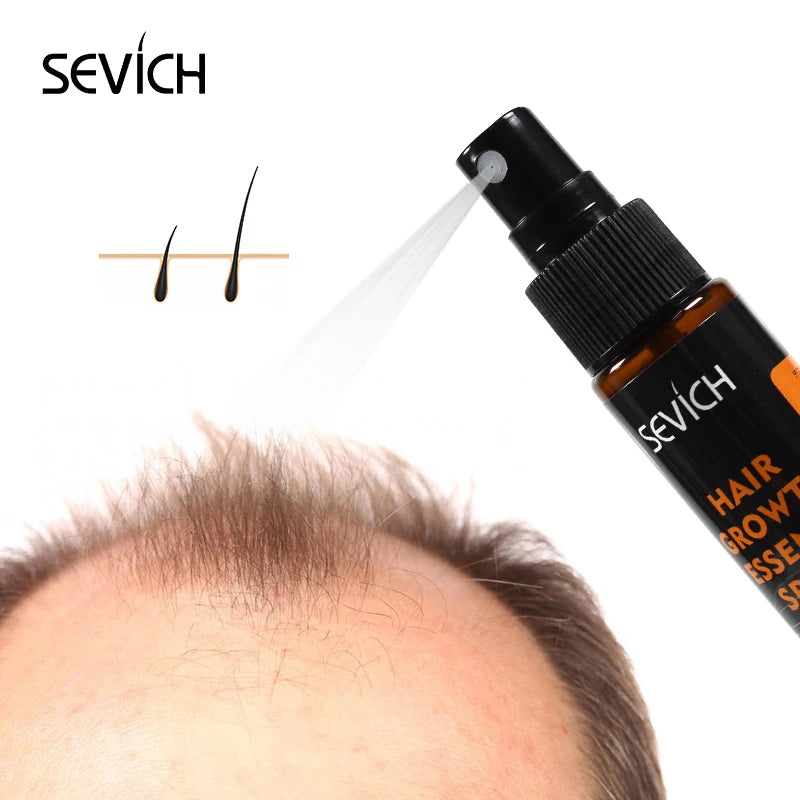 Natural Ginger Hair Growth Essence Oil 30ml Anti Alopecia Dense Regrowth Sprayer Powerful Hair Growth Serums Hair Loss Products