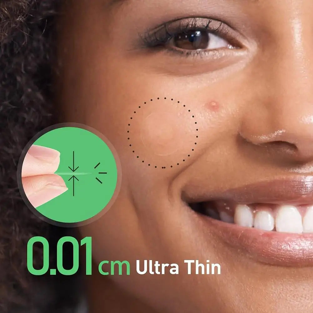 24PCS Microneedle Acne Patch Painlessly Penetrate Acne Patches Blemishes Pimples Covering Patch Daily Unisex Skincare Ultra-fine