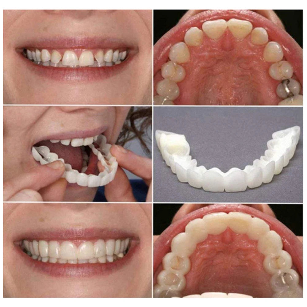 Snap-On Smile Teeth Cover – Instant Whitening Cosmetic Denture (2 Pairs)