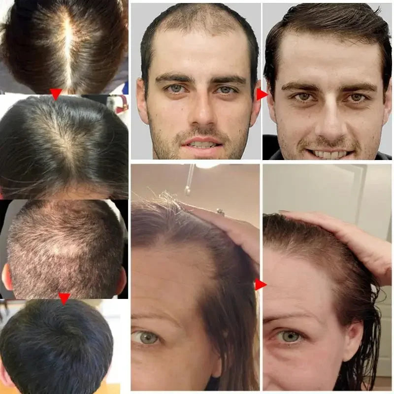 7 Days Fast Hair Growth Serum Prevent Hair Loss Hair Regrowth Essential Oil Repair Damaged Hair Roots Hair Care For Women Men